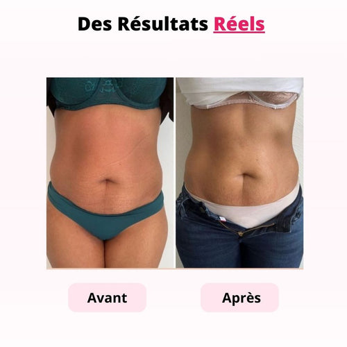 Lumera Pro™ –  Adieu au “ventre de cortisol”