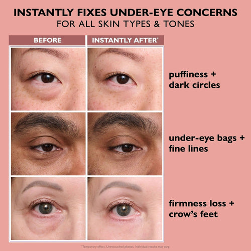 EyeLift+  Instant Under Eye Lift in 5 Minutes