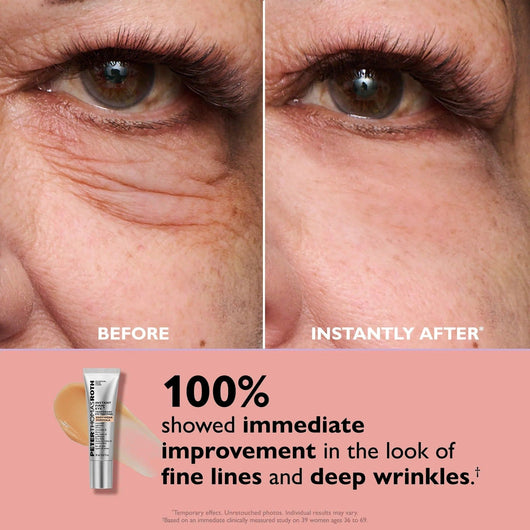 EyeLift+  Instant Under Eye Lift in 5 Minutes