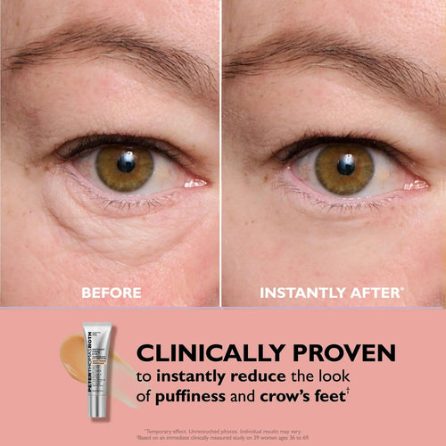 EyeLift+  Instant Under Eye Lift in 5 Minutes