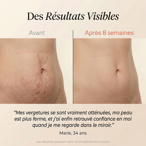 Lumera Pro™ – Adieu le Ventre Post-Partum