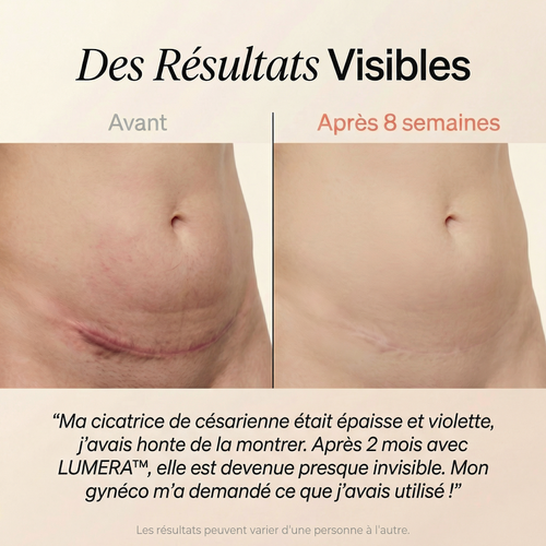 Lumera Pro™ – Adieu le Ventre Post-Partum
